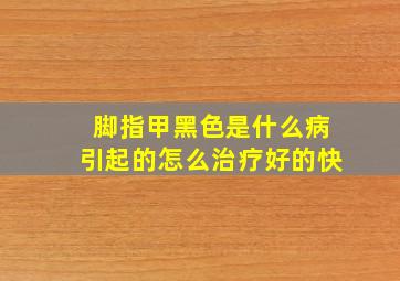 脚指甲黑色是什么病引起的怎么治疗好的快