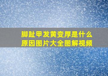 脚趾甲发黄变厚是什么原因图片大全图解视频