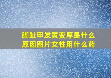 脚趾甲发黄变厚是什么原因图片女性用什么药