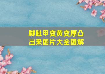 脚趾甲变黄变厚凸出来图片大全图解