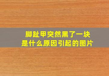 脚趾甲突然黑了一块是什么原因引起的图片