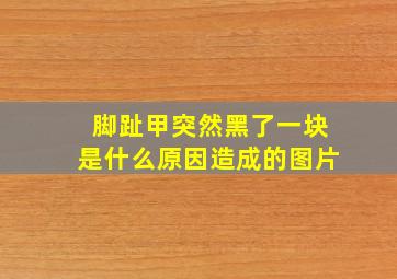 脚趾甲突然黑了一块是什么原因造成的图片