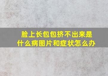 脸上长包包挤不出来是什么病图片和症状怎么办