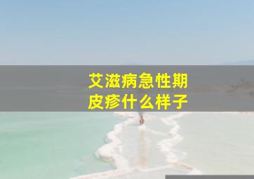 艾滋病急性期皮疹什么样子