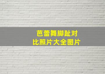 芭蕾舞脚趾对比照片大全图片