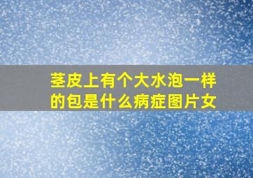 茎皮上有个大水泡一样的包是什么病症图片女