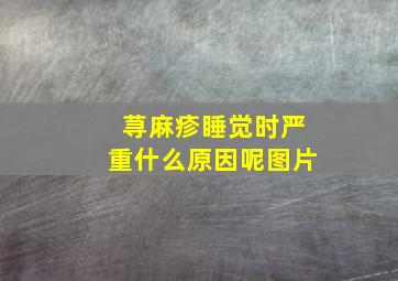 荨麻疹睡觉时严重什么原因呢图片