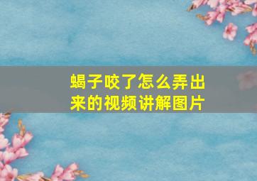 蝎子咬了怎么弄出来的视频讲解图片