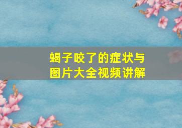 蝎子咬了的症状与图片大全视频讲解