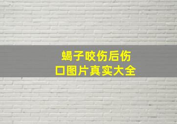 蝎子咬伤后伤口图片真实大全