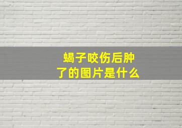 蝎子咬伤后肿了的图片是什么