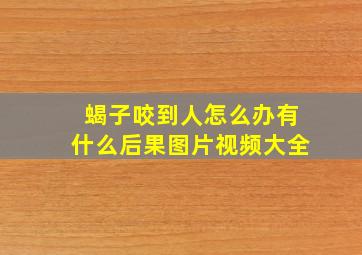 蝎子咬到人怎么办有什么后果图片视频大全