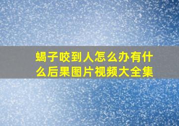 蝎子咬到人怎么办有什么后果图片视频大全集