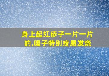 身上起红疹子一片一片的,嗓子特别疼易发烧