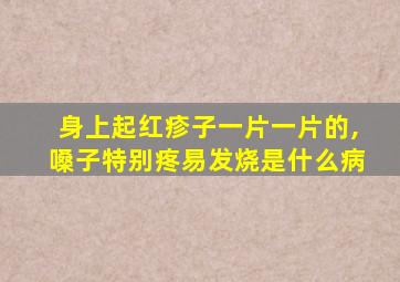 身上起红疹子一片一片的,嗓子特别疼易发烧是什么病