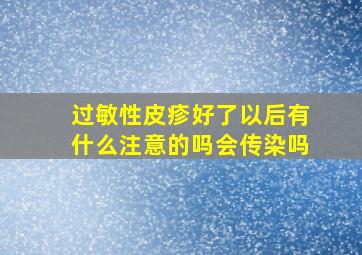 过敏性皮疹好了以后有什么注意的吗会传染吗