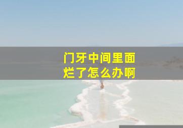 门牙中间里面烂了怎么办啊