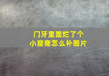 门牙里面烂了个小窟窿怎么补图片