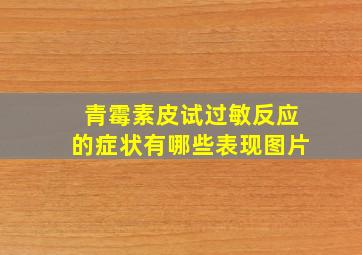 青霉素皮试过敏反应的症状有哪些表现图片