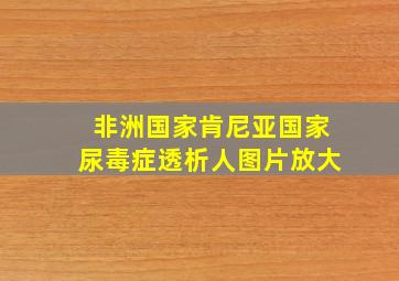 非洲国家肯尼亚国家尿毒症透析人图片放大