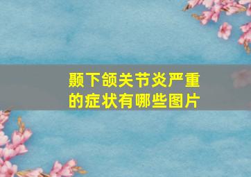 颞下颌关节炎严重的症状有哪些图片