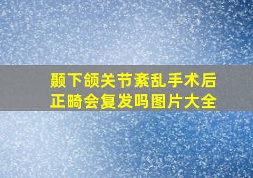 颞下颌关节紊乱手术后正畸会复发吗图片大全