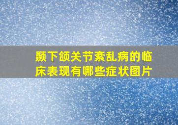 颞下颌关节紊乱病的临床表现有哪些症状图片