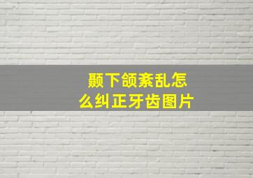 颞下颌紊乱怎么纠正牙齿图片