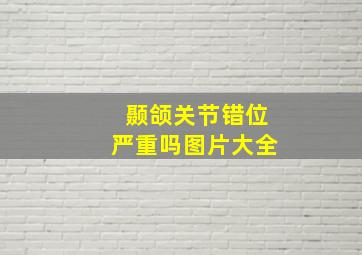 颞颌关节错位严重吗图片大全