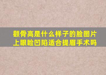 颧骨高是什么样子的脸图片上眼睑凹陷适合提眉手术吗