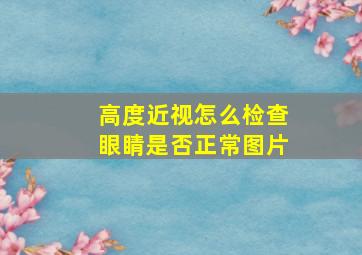 高度近视怎么检查眼睛是否正常图片