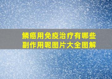 鳞癌用免疫治疗有哪些副作用呢图片大全图解