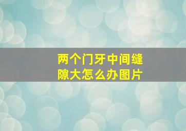 两个门牙中间缝隙大怎么办图片