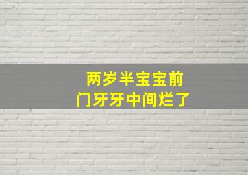 两岁半宝宝前门牙牙中间烂了