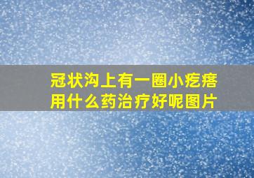 冠状沟上有一圈小疙瘩用什么药治疗好呢图片