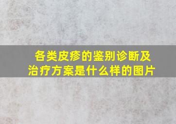 各类皮疹的鉴别诊断及治疗方案是什么样的图片