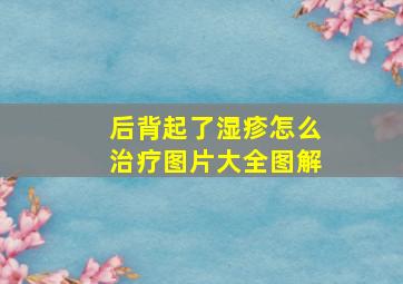 后背起了湿疹怎么治疗图片大全图解