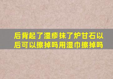 后背起了湿疹抹了炉甘石以后可以擦掉吗用湿巾擦掉吗