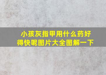 小孩灰指甲用什么药好得快呢图片大全图解一下