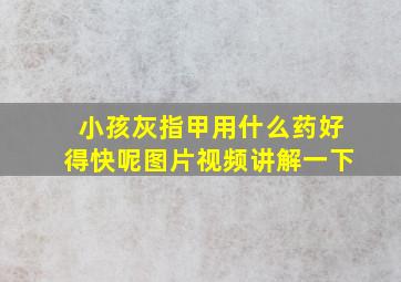 小孩灰指甲用什么药好得快呢图片视频讲解一下