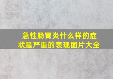 急性肠胃炎什么样的症状是严重的表现图片大全