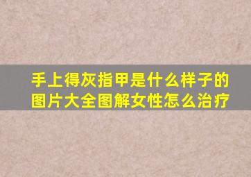 手上得灰指甲是什么样子的图片大全图解女性怎么治疗