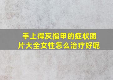 手上得灰指甲的症状图片大全女性怎么治疗好呢