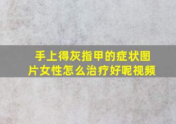 手上得灰指甲的症状图片女性怎么治疗好呢视频