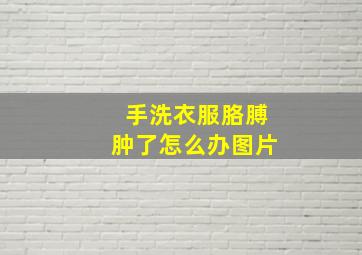 手洗衣服胳膊肿了怎么办图片