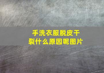 手洗衣服脱皮干裂什么原因呢图片