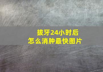 拔牙24小时后怎么消肿最快图片