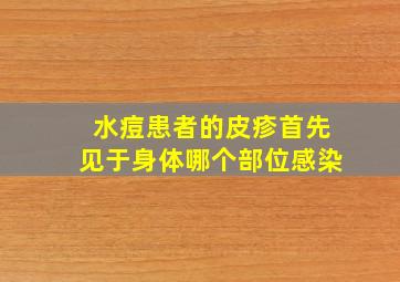 水痘患者的皮疹首先见于身体哪个部位感染