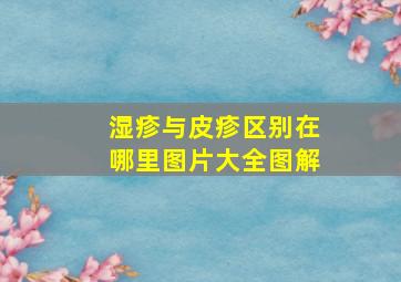 湿疹与皮疹区别在哪里图片大全图解