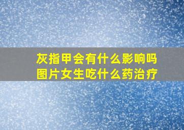 灰指甲会有什么影响吗图片女生吃什么药治疗